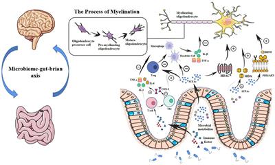 Pathogenesis from the microbial-gut-brain axis in white matter injury in preterm infants: A review